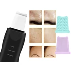 Kép 6/10 - Ultrahangos arctisztító masszírozó, fekete