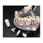 Kép 3/10 - Fogászati ​​modell