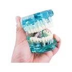 Kép 9/10 - Fogászati ​​modell