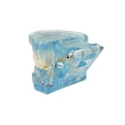 Kép 2/10 - Fogászati ​​modell