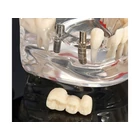 Kép 6/10 - Fogászati ​​modell