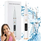 Kép 1/6 - Ultrahangos fogkő eltávolító 2 cserefejjel