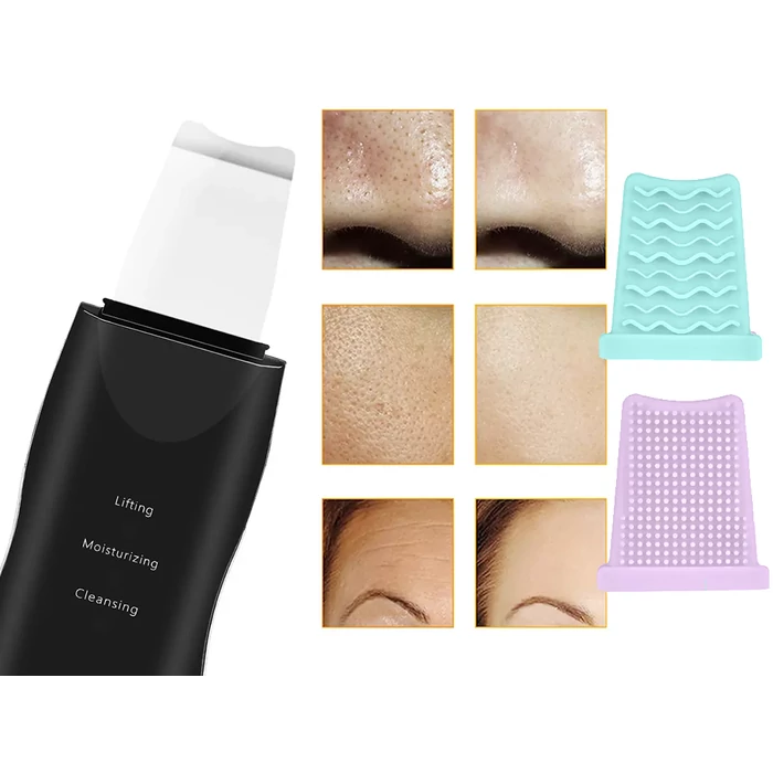 Ultrahangos arctisztító masszírozó, fekete