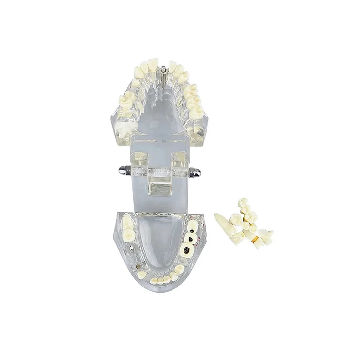 Fogászati ​​modell