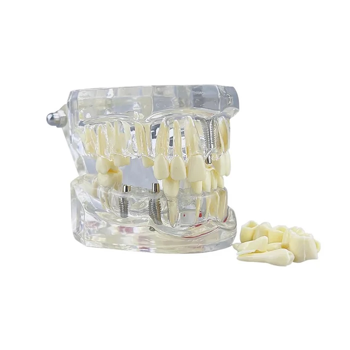 Fogászati ​​modell