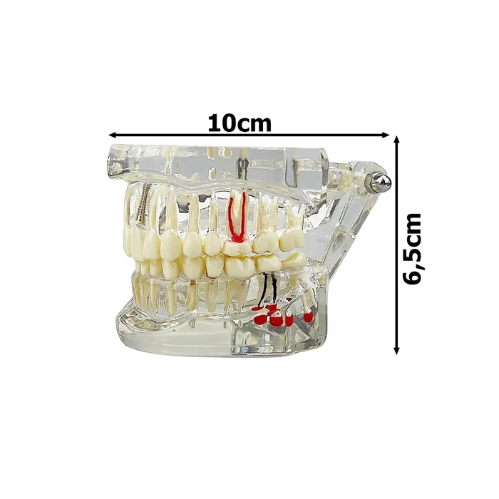 Fogászati ​​modell