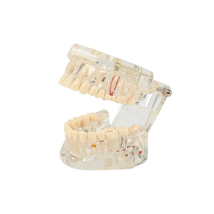 Fogászati ​​modell