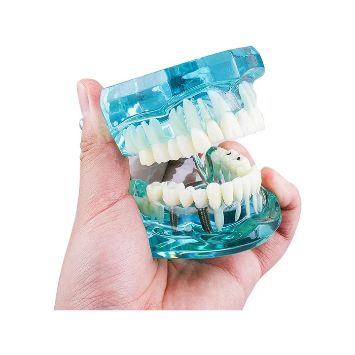 Fogászati ​​modell