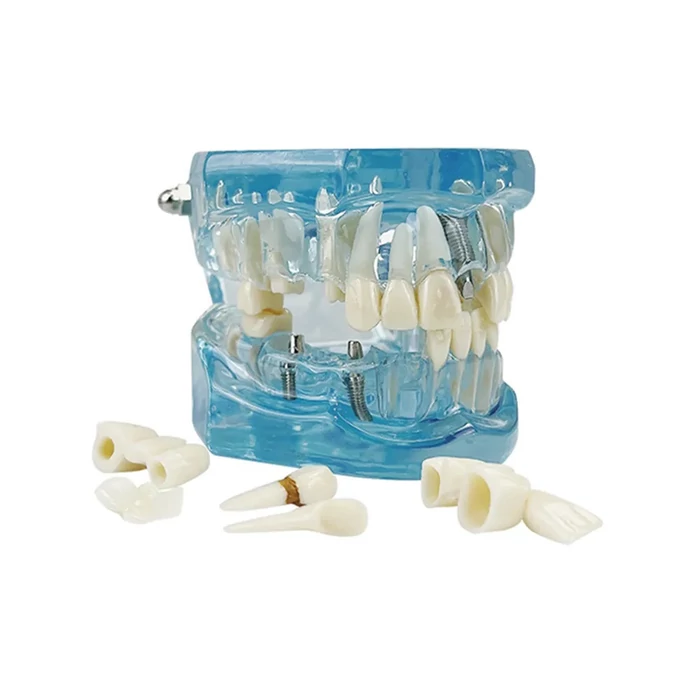 Fogászati ​​modell