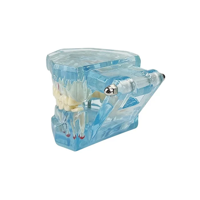 Fogászati ​​modell