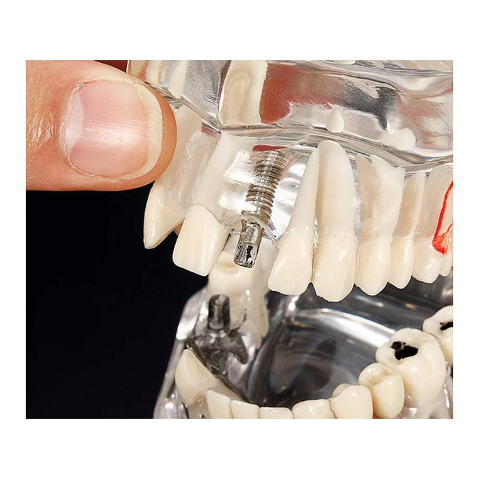 Fogászati ​​modell